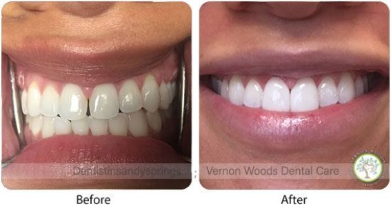 Before and After Photos